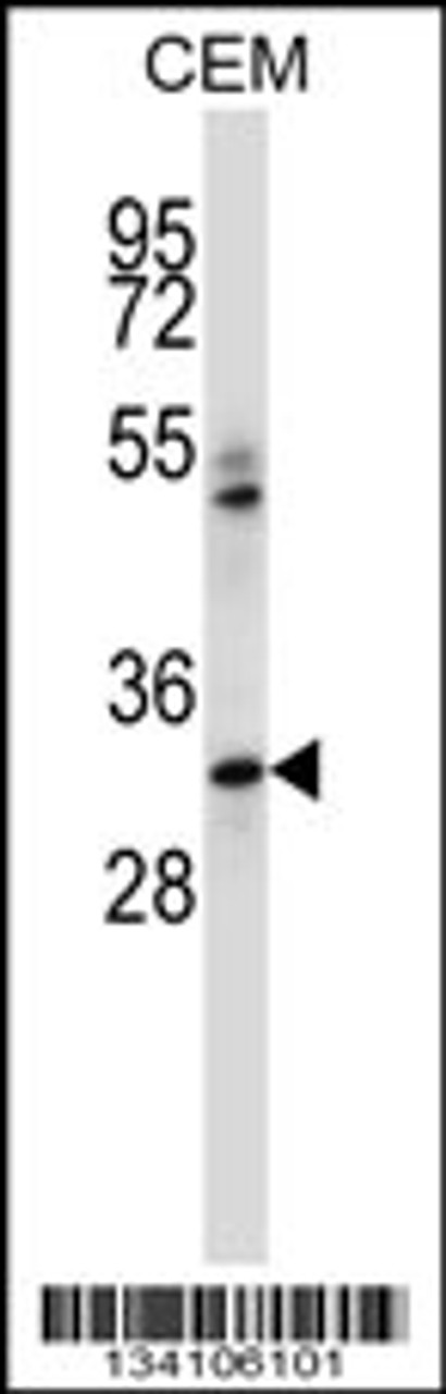 Western blot analysis in CEM cell line lysates (35ug/lane) .