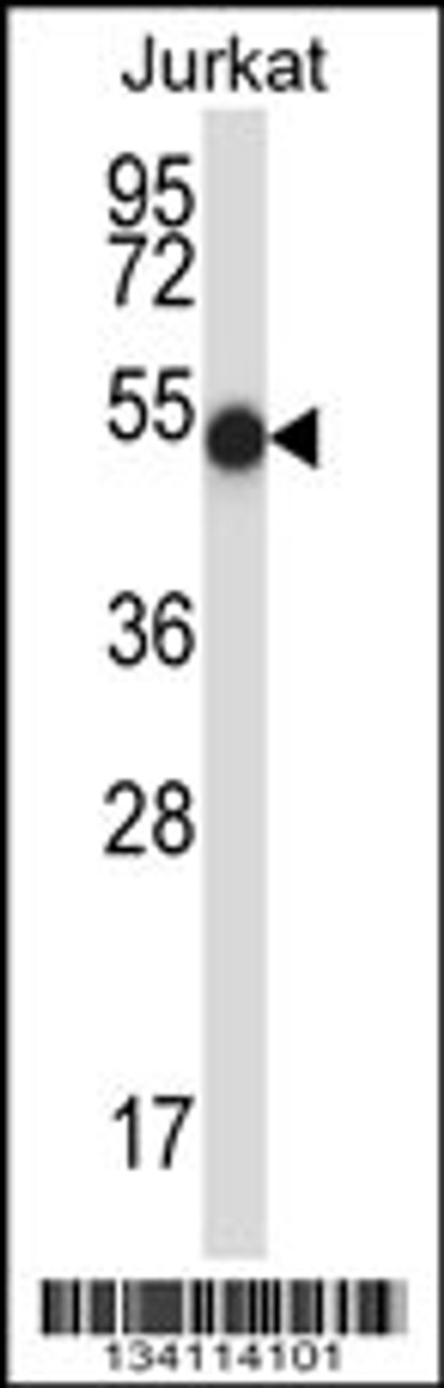 Western blot analysis in Jurkat cell line lysates (35ug/lane) .