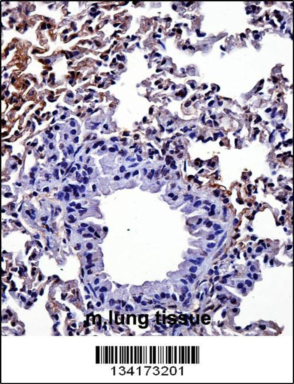 Mouse Hipk4 Antibody immunohistochemistry analysis in formalin fixed and paraffin embedded mouse lung tissue followed by peroxidase conjugation of the secondary antibody and DAB staining.