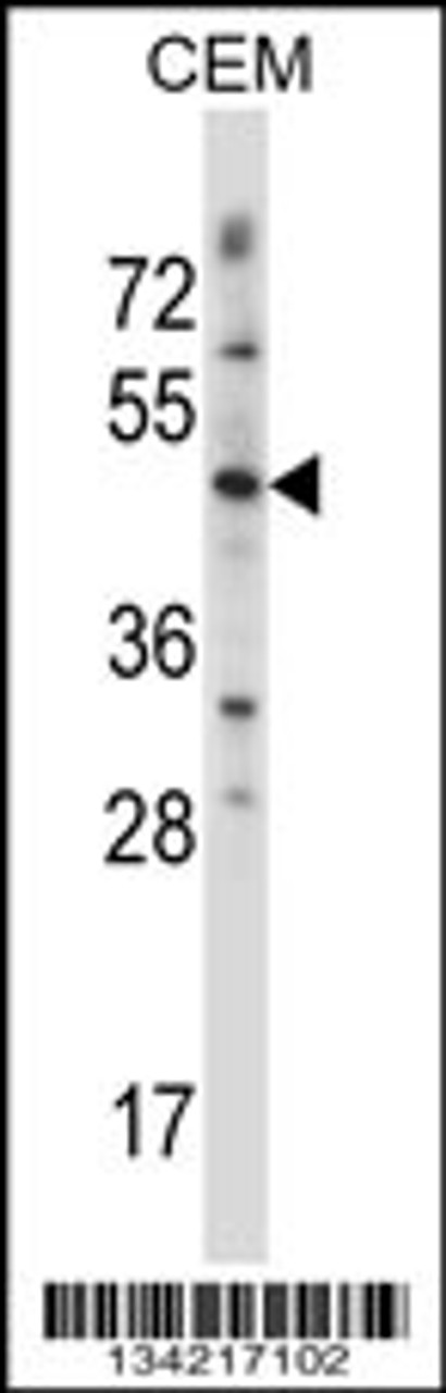 Western blot analysis in CEM cell line lysates (35ug/lane) .