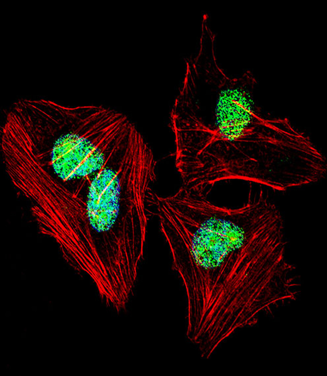 Fluorescent confocal image of Hela cell stained with NFIA Antibody .Hela cells were fixed with 4% PFA (20 min) , permeabilized with Triton X-100 (0.1%, 10 min) , then incubated with NFIA primary antibody (1:25) . For secondary antibody, Alexa Fluor 488 conjugated donkey anti-rabbit antibody (green) was used (1:400) .Cytoplasmic actin was counterstained with Alexa Fluor 555 (red) conjugated Phalloidin (7units/ml) . Nuclei were counterstained with DAPI (blue) (10 ug/ml, 10 min) . NFIA immunoreactivity is localized to Nucleus significantly.