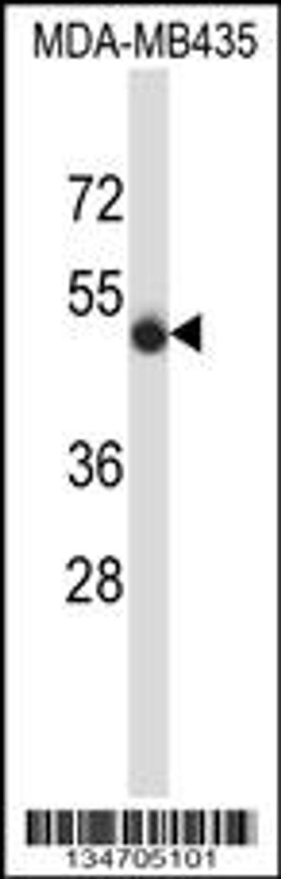 Western blot analysis in MDA-MB435 cell line lysates (35ug/lane) .