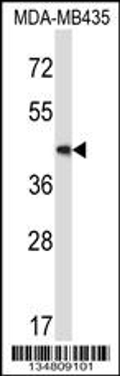 Western blot analysis in MDA-MB435 cell line lysates (35ug/lane) .