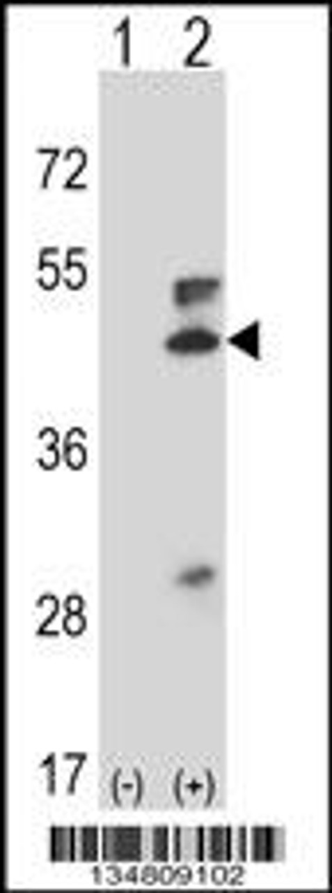 Western blot analysis of Map2k5 using rabbit polyclonal Mouse Map2k5 Antibody using 293 cell lysates (2 ug/lane) either nontransfected (Lane 1) or transiently transfected (Lane 2) with the Map2k5 gene.