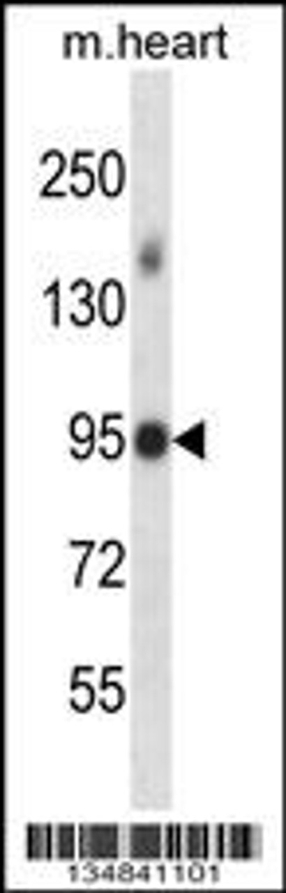 Western blot analysis in mouse heart tissue lysates (35ug/lane) .