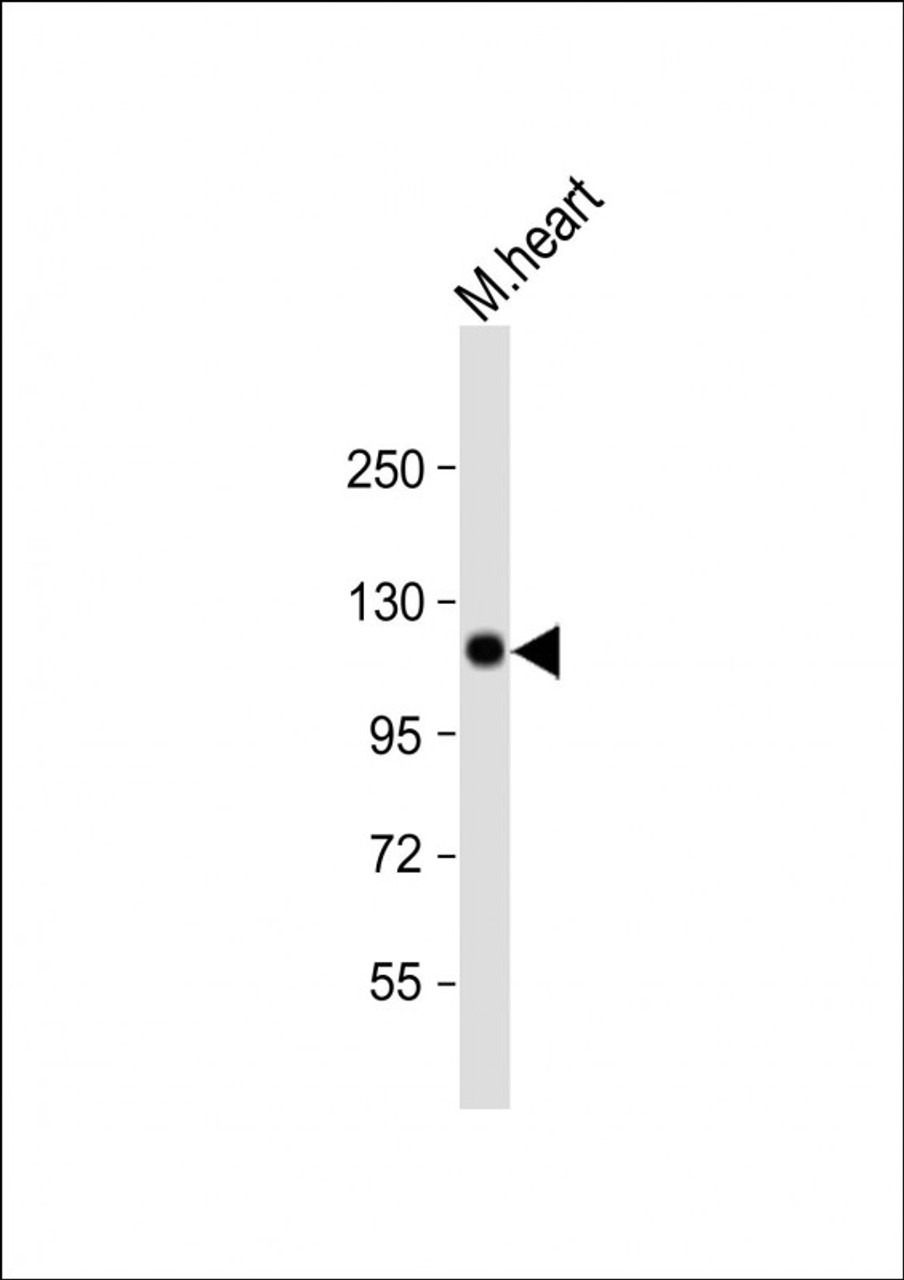 Western Blot at 1:1000 dilution + mouse heart lysate Lysates/proteins at 20 ug per lane.