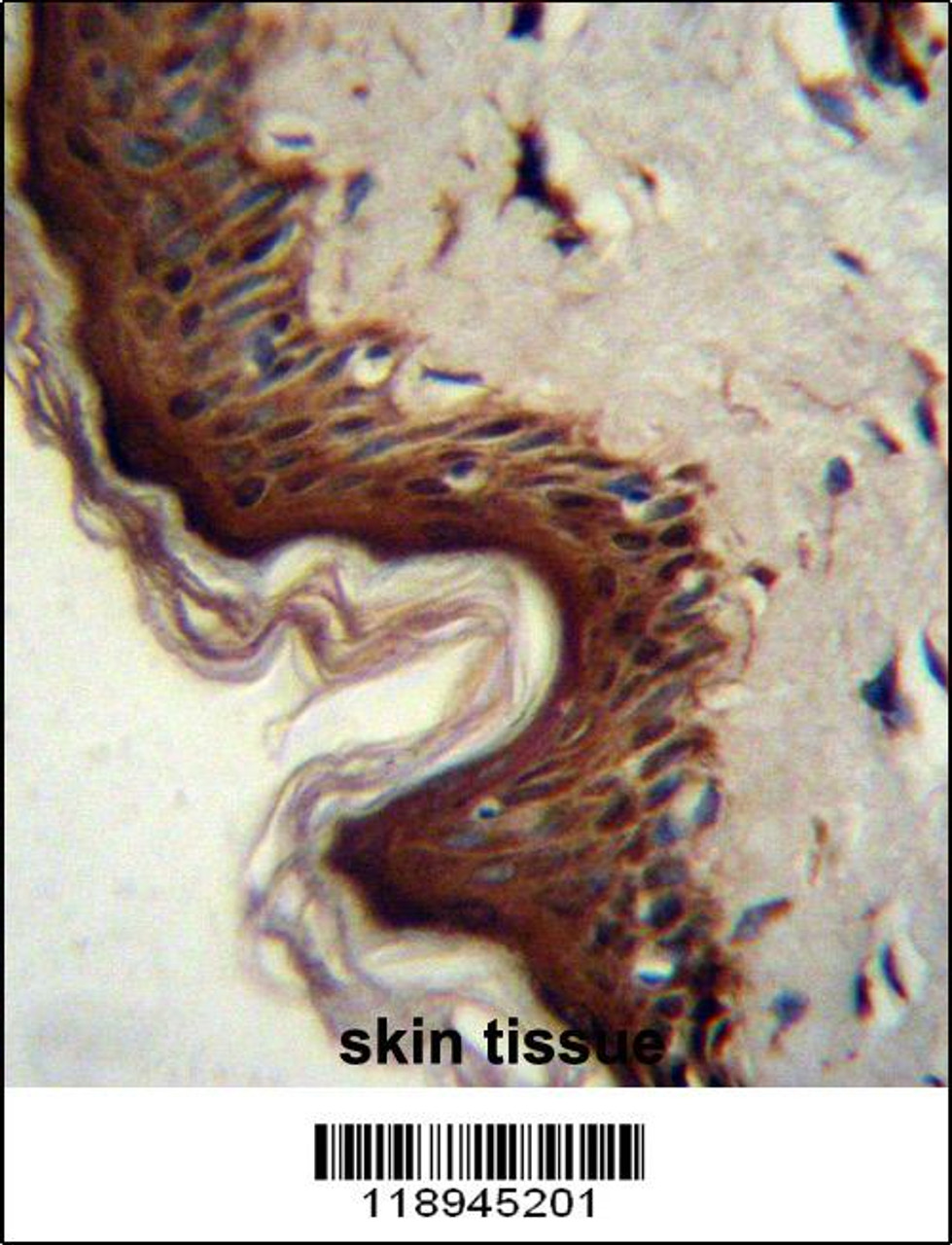 PPL Antibody immunohistochemistry analysis in formalin fixed and paraffin embedded human skin tissue followed by peroxidase conjugation of the secondary antibody and DAB staining.