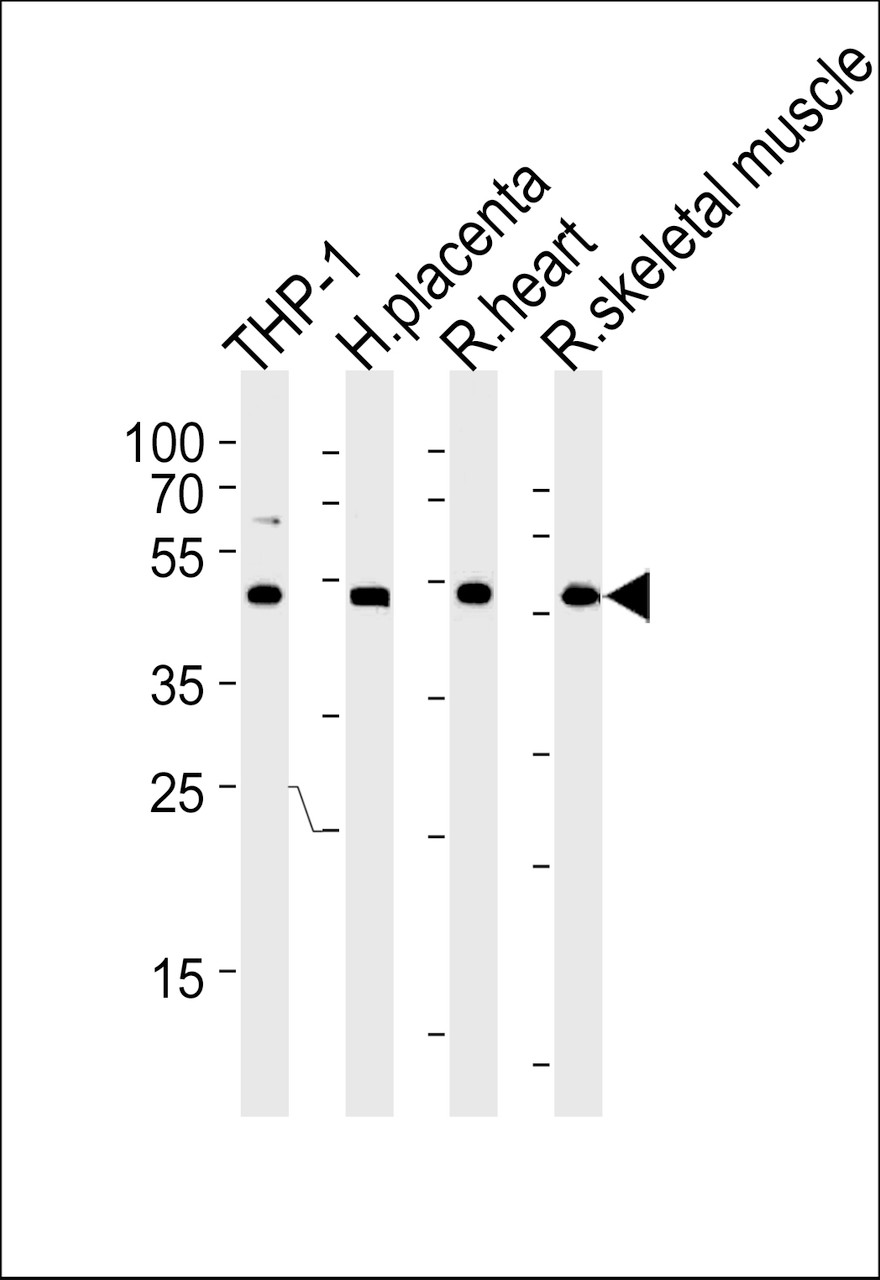 Western blot analysis in THP-1 cell line, human placenta, rat heart and skeletal muscle lysates (35ug/lane) .