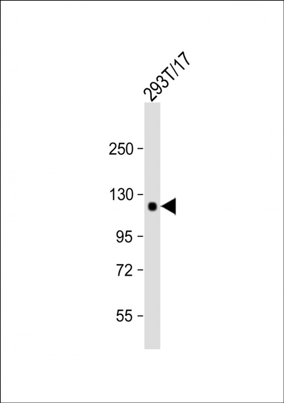 Western Blot at 1:1000 dilution + 293T/17 whole cell lysate Lysates/proteins at 20 ug per lane.