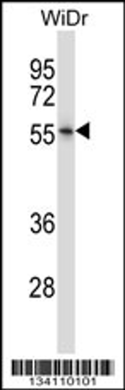 Western blot analysis in WiDr cell line lysates (35ug/lane) .