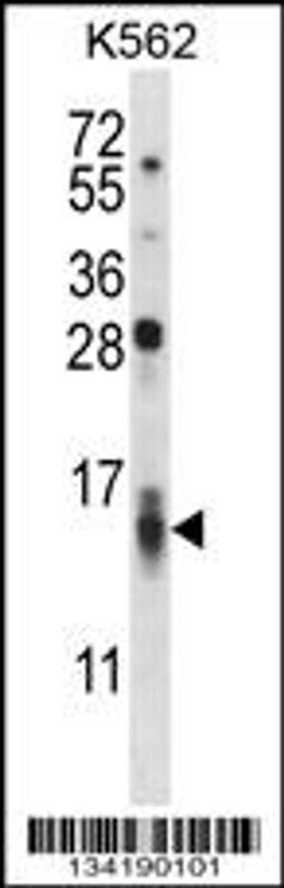 Western blot analysis in K562 cell line lysates (35ug/lane) .