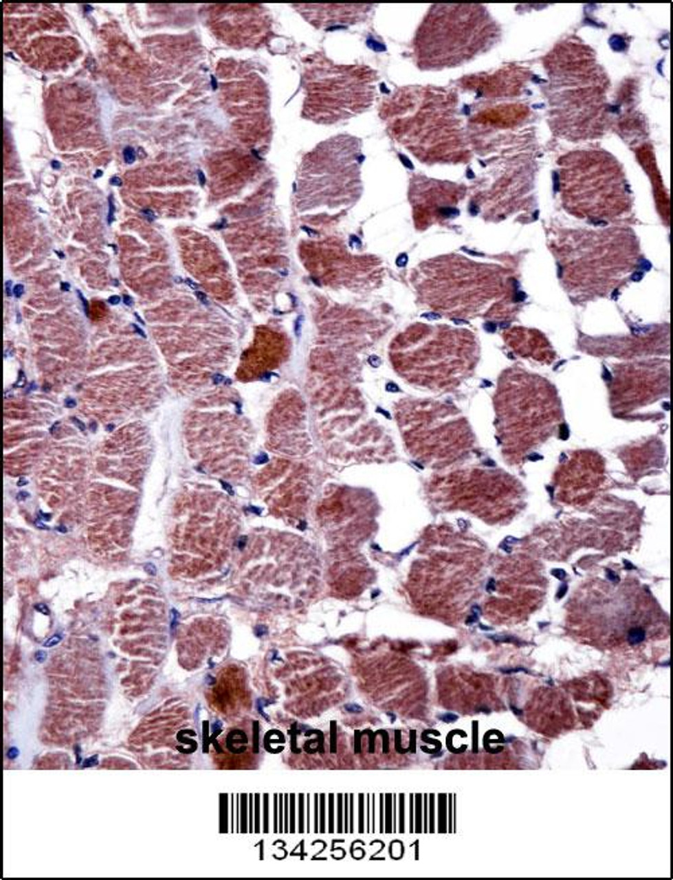 RGS9 Antibody immunohistochemistry analysis in formalin fixed and paraffin embedded human skeletal muscle followed by peroxidase conjugation of the secondary antibody and DAB staining.