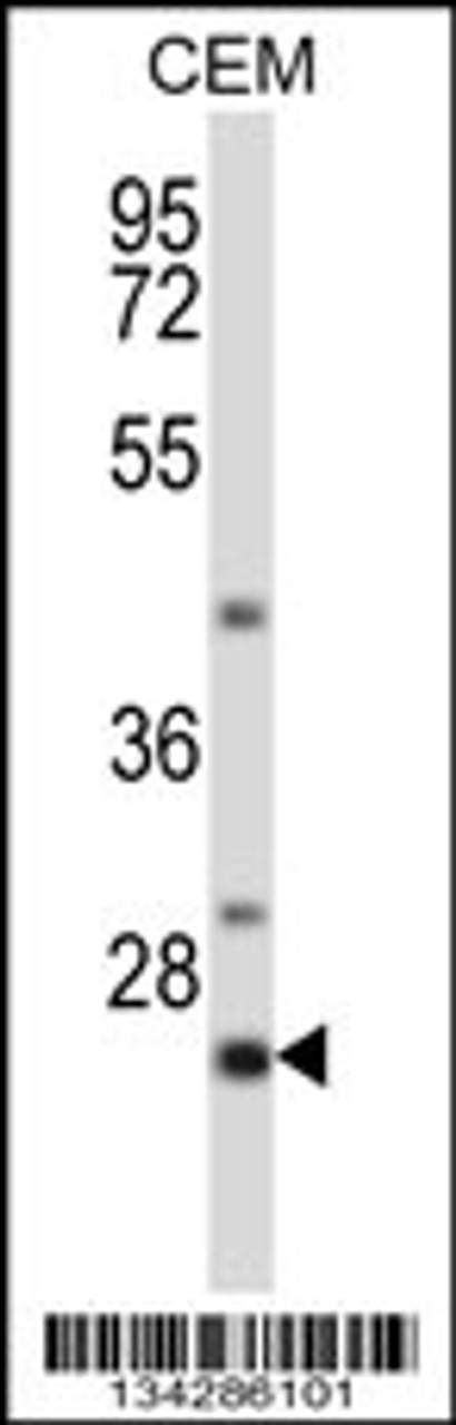 Western blot analysis in CEM cell line lysates (35ug/lane) .