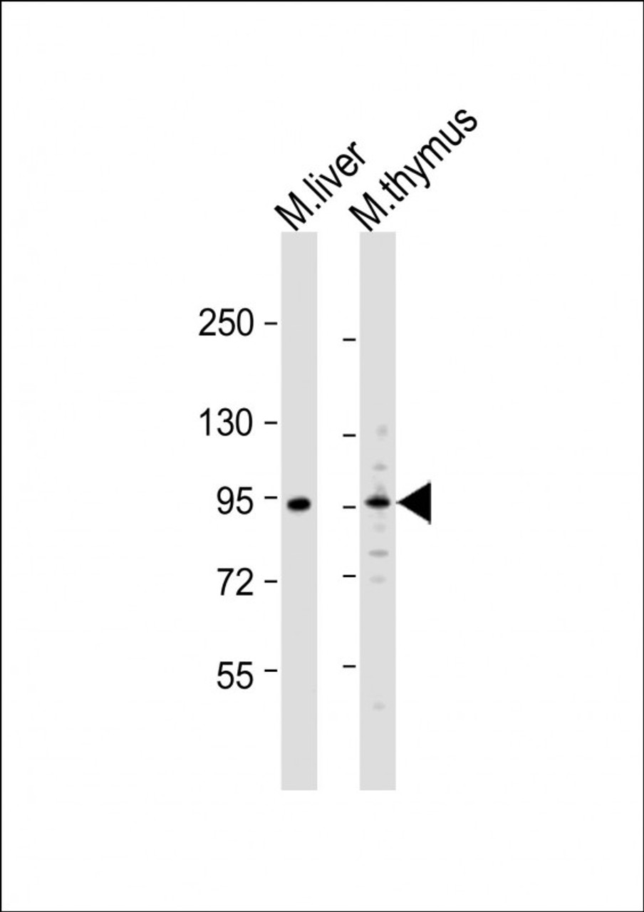 Western Blot at 1:1000 dilution Lane 1: mouse liver lysate Lane 2: mouse thymus lysate Lysates/proteins at 20 ug per lane.