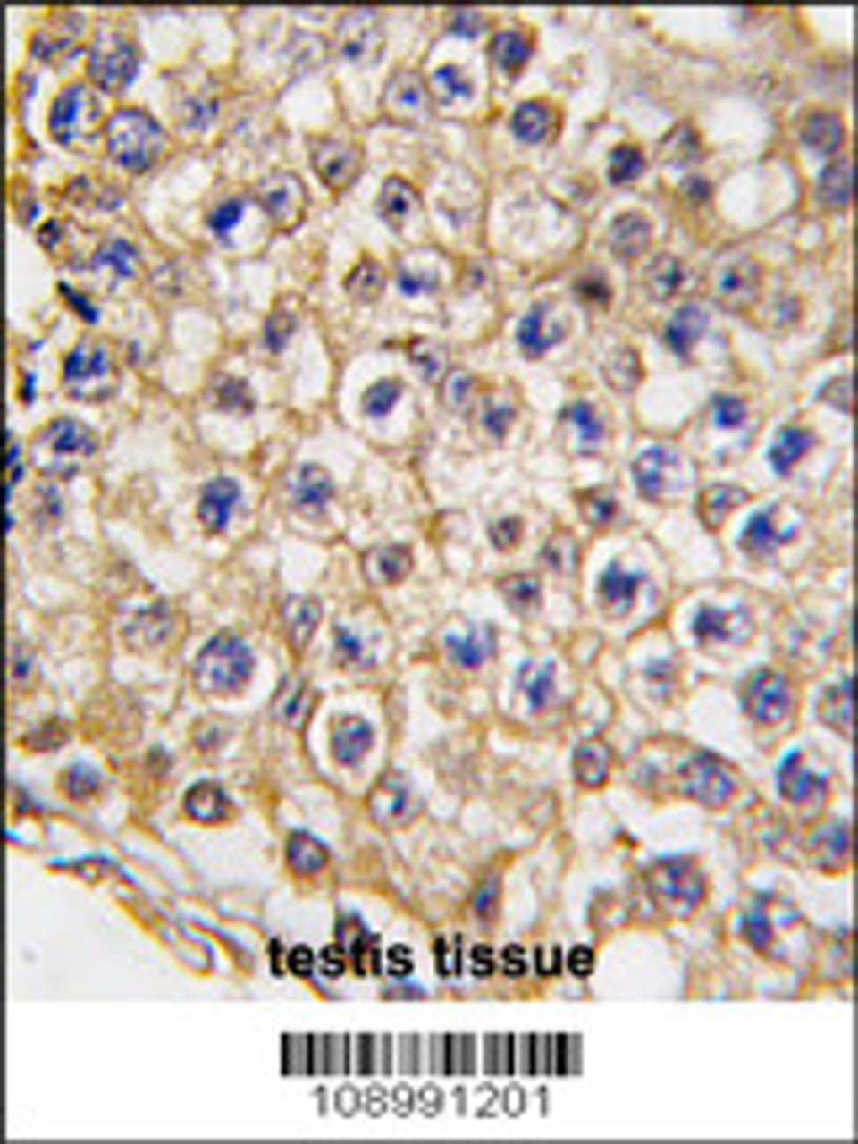 Formalin-fixed and paraffin-embedded human testis tissue reacted with TRPV3 Antibody, which was peroxidase-conjugated to the secondary antibody, followed by DAB staining.