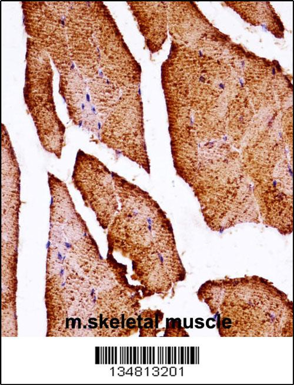 Mouse Map3k10 Antibody immunohistochemistry analysis in formalin fixed and paraffin embedded mouse skeletal muscle followed by peroxidase conjugation of the secondary antibody and DAB staining.