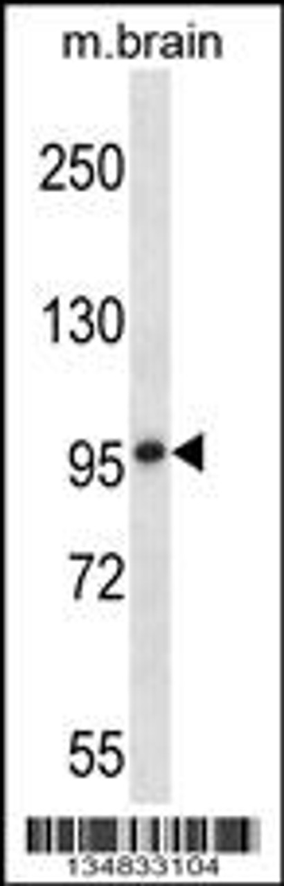 Western blot analysis in mouse brain tissue lysates (35ug/lane) .