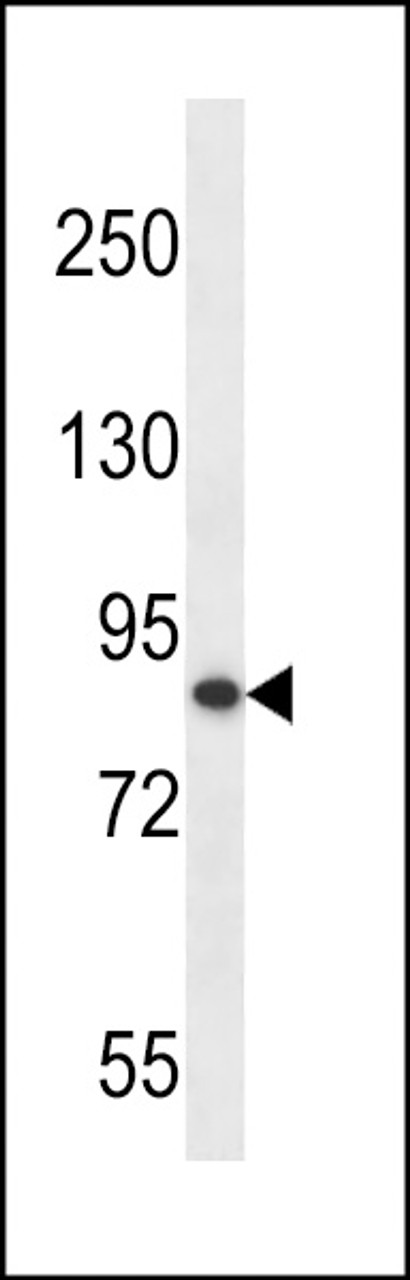 Western blot analysis in MDA-MB453 cell line lysates (35ug/lane) .