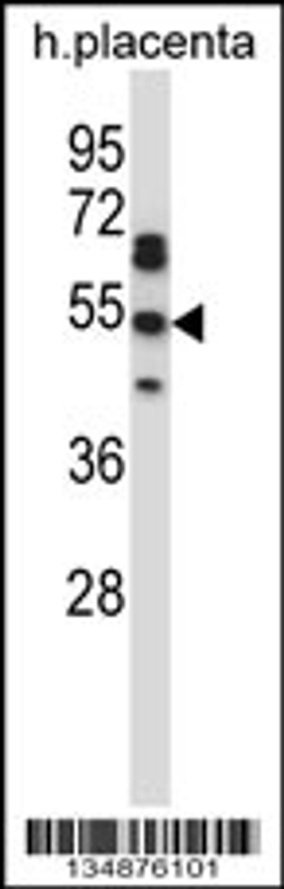 Western blot analysis in human placenta tissue lysates (35ug/lane) .