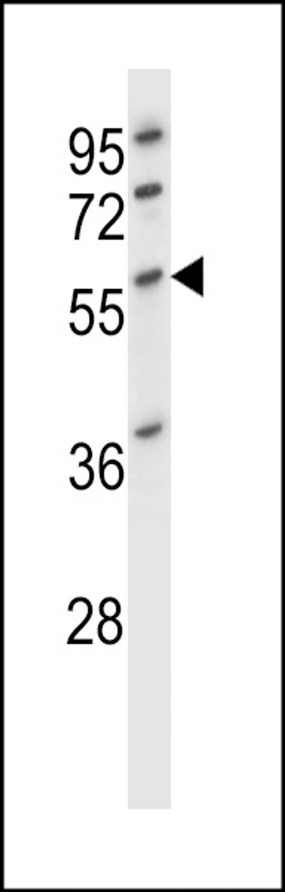 Western blot analysis in HL-60 cell line lysates (35ug/lane) .This demonstrates the DES antibody detected the DES protein (arrow) .