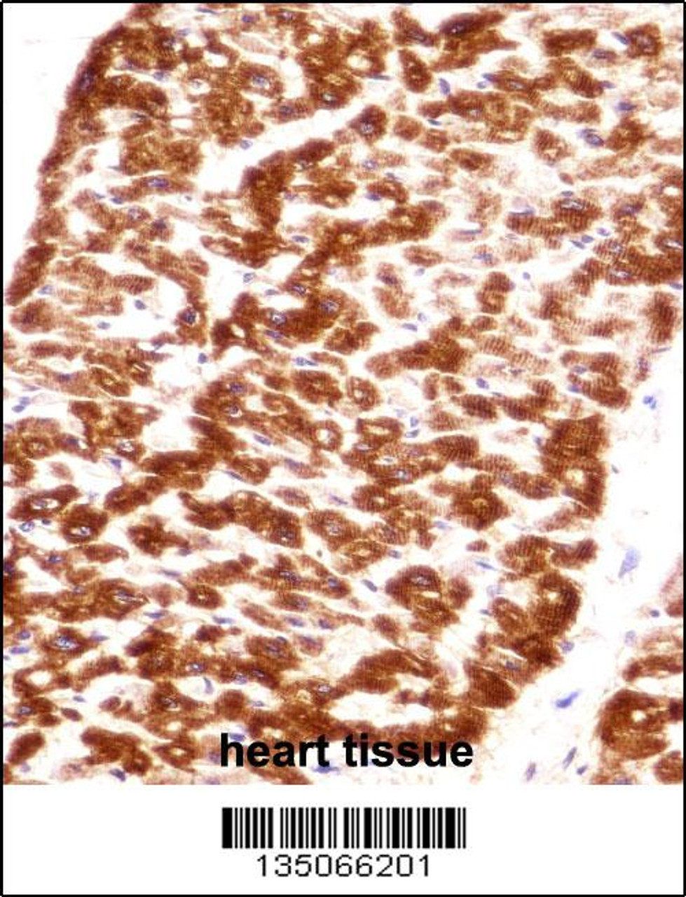 DES/Desmin (Muscle Cell Marker) Antibody immunohistochemistry analysis in formalin fixed and paraffin embedded human heart tissue followed by peroxidase conjugation of the secondary antibody and DAB staining.This data demonstrates the use of DES/Desmin (Muscle Cell Marker) Antibody for immunohistochemistry.