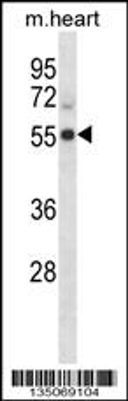 Western blot analysis in mouse heart tissue lysates (35ug/lane) .