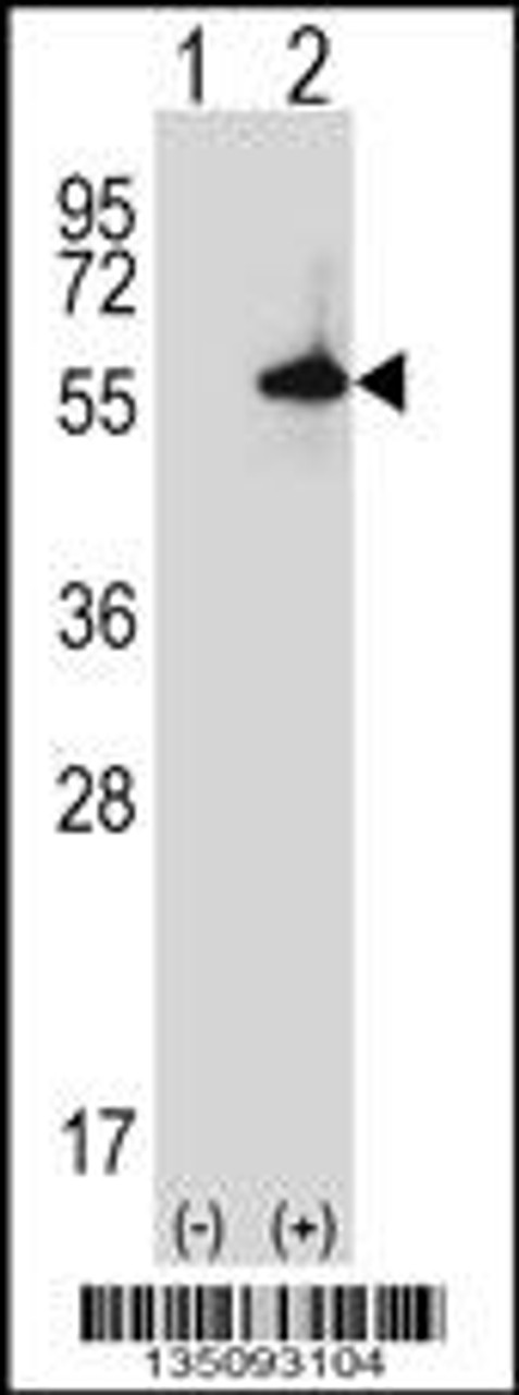 Western blot analysis of Sgk3 using rabbit polyclonal Mouse Sgk3 Antibody using 293 cell lysates (2 ug/lane) either nontransfected (Lane 1) or transiently transfected (Lane 2) with the Sgk3 gene.