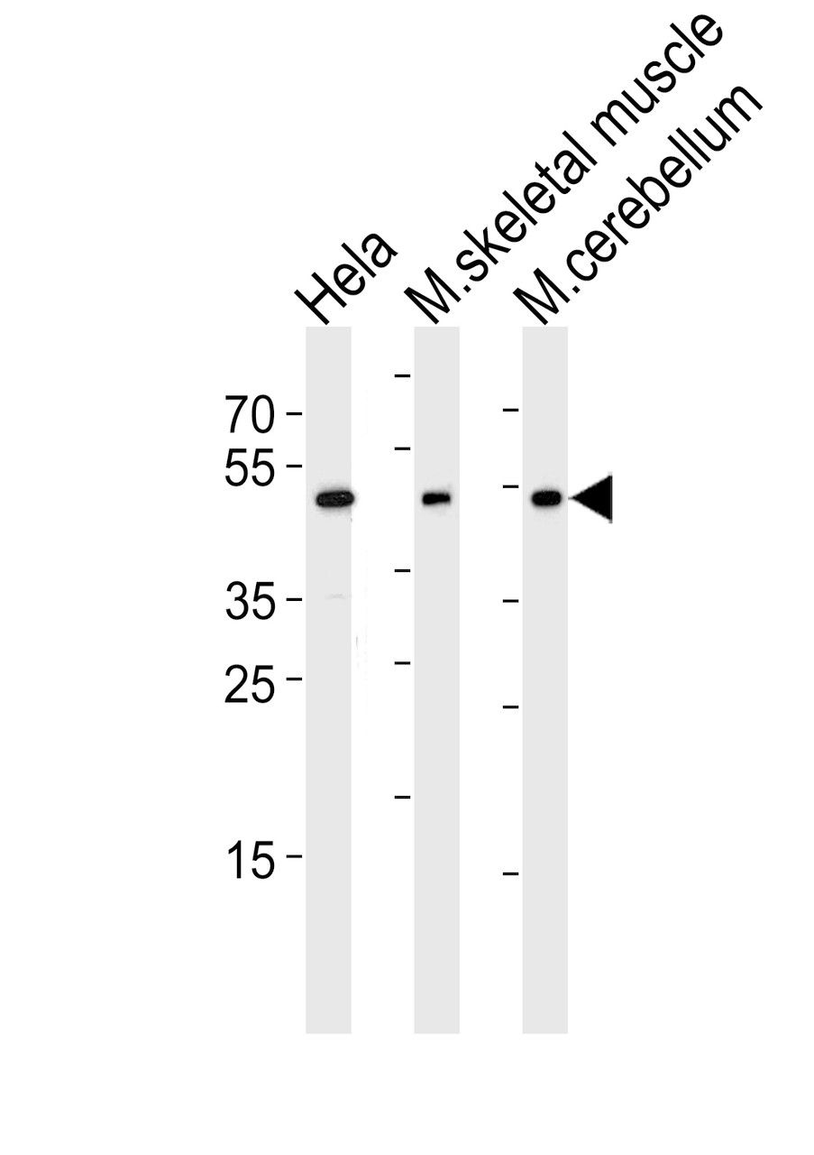 Western blot analysis of lysates from Hela cell line, mouse skeletal muscle and mouse cerebellum tissue lysate (from left to right) , using Mouse Hoxc10 Antibody at 1:1000 at each lane.