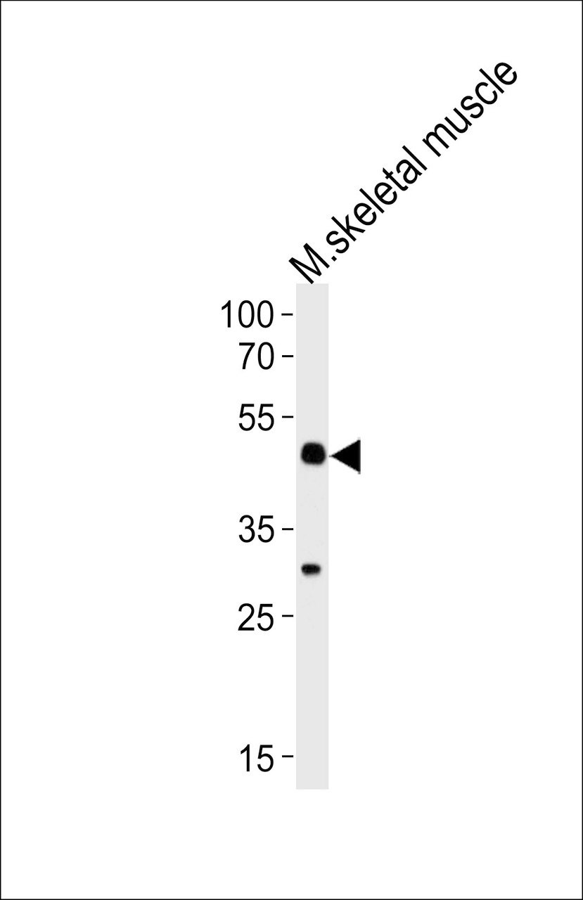 Western blot analysis of lysate from mouse skeletal muscle tissue lysate, using Mouse Hoxc10 Antibody at 1:1000 at each lane.