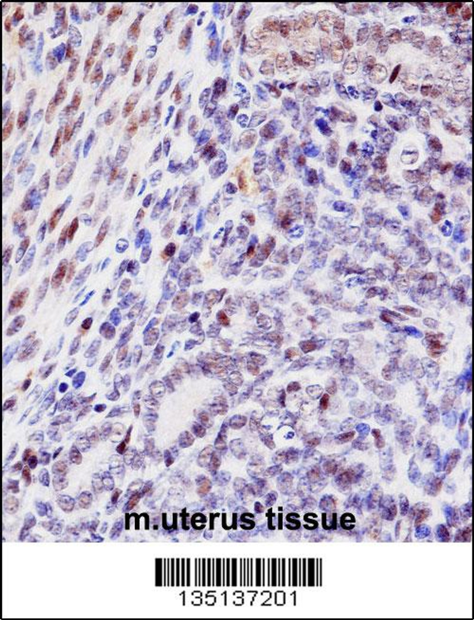 Mouse Hoxd10 Antibody immunohistochemistry analysis in formalin fixed and paraffin embedded mouse uterus tissue followed by peroxidase conjugation of the secondary antibody and DAB staining.