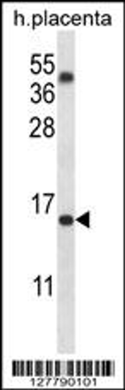 Western blot analysis in human placenta tissue lysates (35ug/lane) .