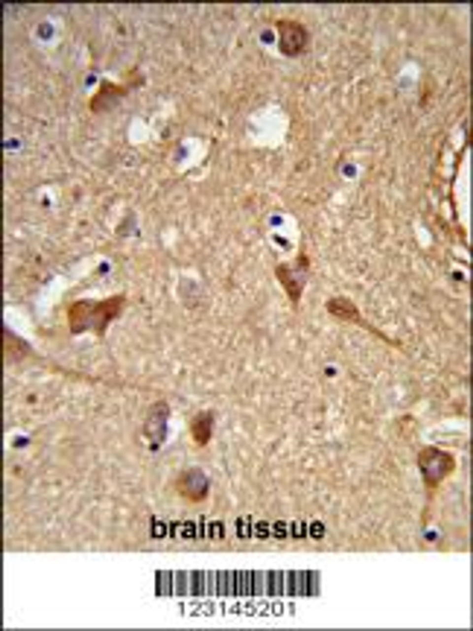 Formalin-fixed and paraffin-embedded human brain tissue reacted with ALDH2 Antibody, which was peroxidase-conjugated to the secondary antibody, followed by DAB staining.