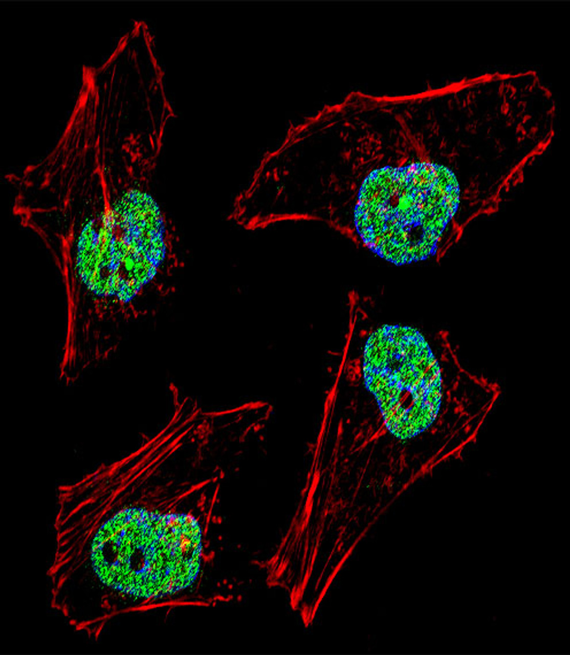 Fluorescent confocal image of Hela cell stained with NFYB Antibody (N-term) . Hela cells were fixed with 4% PFA (20 min) , permeabilized with Triton X-100 (0.1%, 10 min) , then incubated with NFYB primary antibody (1:25) . For secondary antibody, Alexa Fluor 488 conjugated donkey anti-rabbit antibody (green) was used (1:400) .Cytoplasmic actin was counterstained with Alexa Fluor 555 (red) conjugated Phalloidin (7units/ml) . Nuclei were counterstained with DAPI (blue) (10 ug/ml, 10 min) . NFYB immunoreactivity is localized to nucleus significantly.