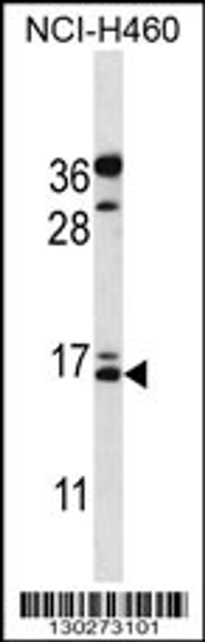 Western blot analysis in NCI-H460 cell line lysates (35ug/lane) .