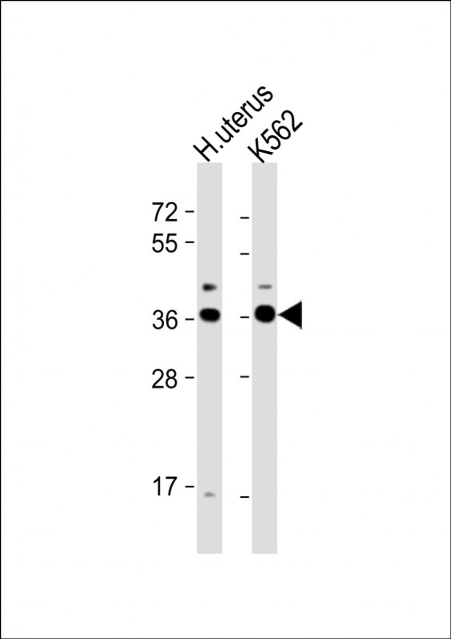 Western Blot at 1:1000 dilution Lane 1: human uterus lysate Lane 2: K562 whole cell lysate Lysates/proteins at 20 ug per lane.