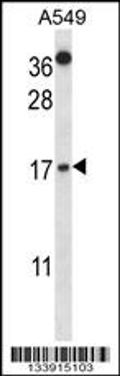 Western blot analysis in A549 cell line lysates (35ug/lane) .