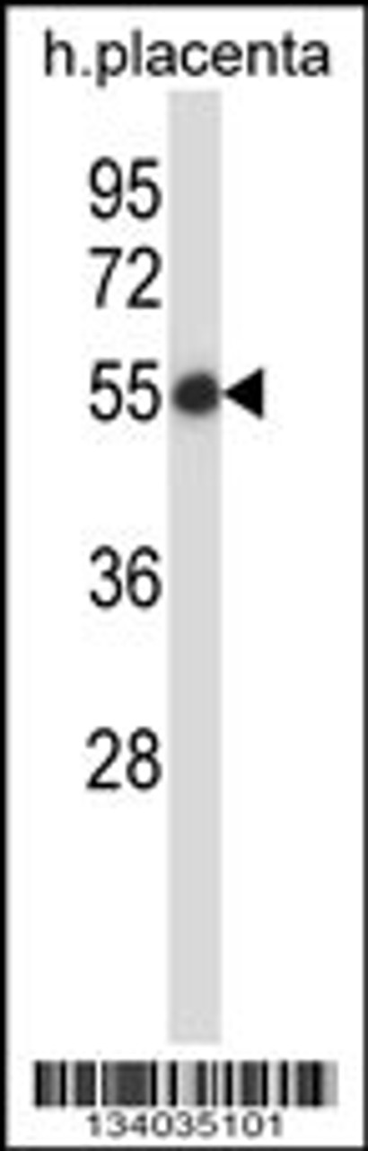 Western blot analysis in human placenta tissue lysates (35ug/lane) .