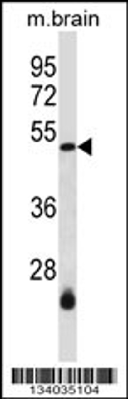 Western blot analysis in mouse brain tissue lysates (35ug/lane) .