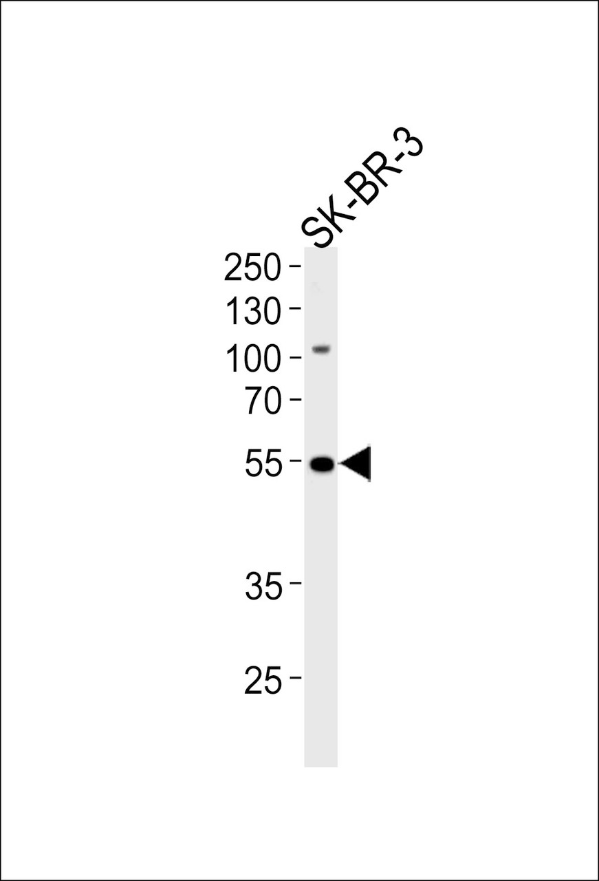 Western blot analysis of lysate from SK-BR-3 cell line, using SMARCE1 Antibody at 1:1000 at each lane.