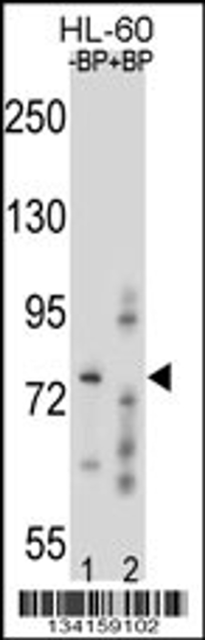 Western blot analysis of RNF40 Antibody Pab pre-incubated without (lane 1) and with (lane 2) blocking peptide in HL-60 cell line lysate.