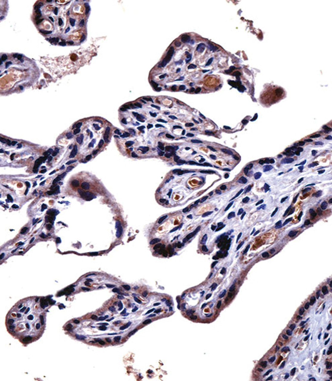 IL9R Antibody immunohistochemistry analysis in formalin fixed and paraffin embedded human placenta tissue followed by peroxidase conjugation of the secondary antibody and DAB staining.