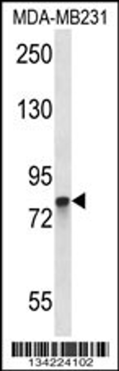 Western blot analysis in MDA-MB231 cell line lysates (35ug/lane) .