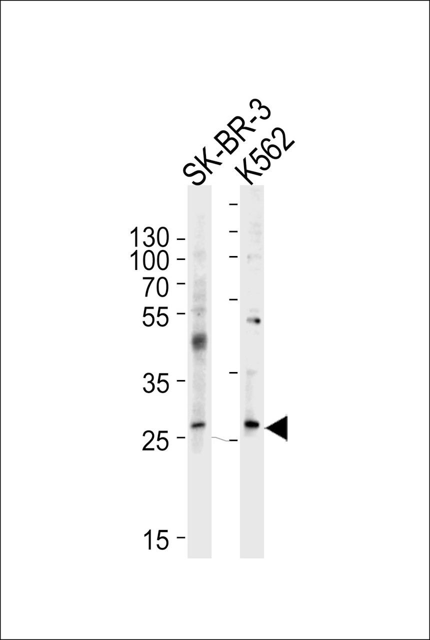 Western blot analysis of lysates from SK-BR-3, K562 cell line (from left to right) , using FRAT1 Antibody at 1:1000 at each lane.