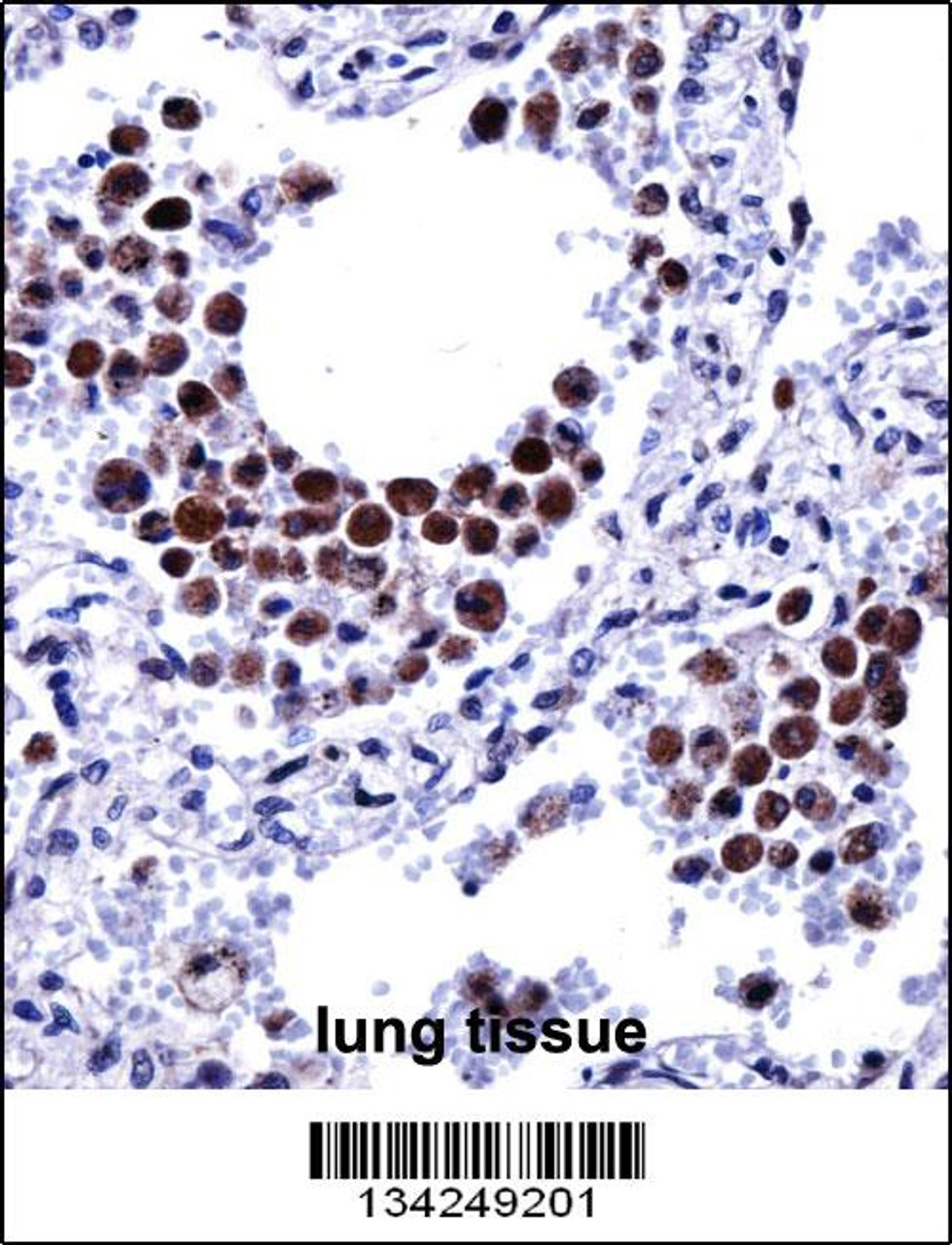 ARIH2 Antibody immunohistochemistry analysis in formalin fixed and paraffin embedded human lung tissue followed by peroxidase conjugation of the secondary antibody and DAB staining.