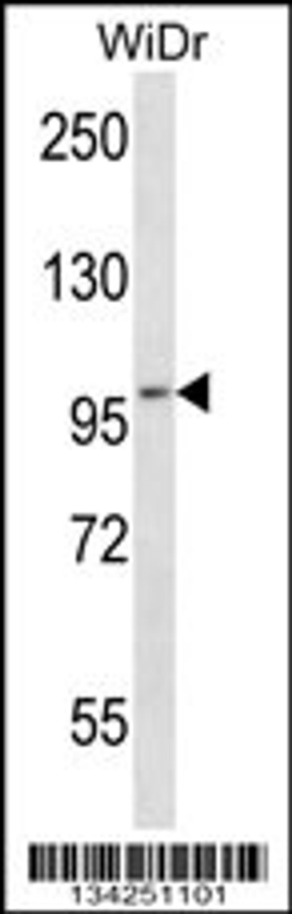 Western blot analysis in WiDr cell line lysates (35ug/lane) .