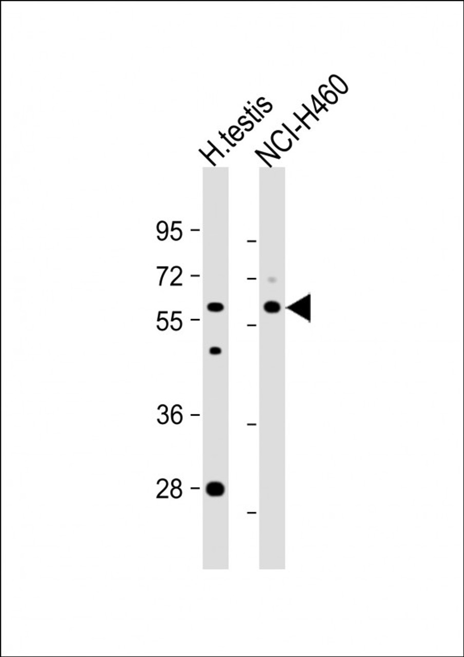 Western Blot at 1:1000 dilution Lane 1: human testis lysate Lane 2: NCI-H460 whole cell lysate Lysates/proteins at 20 ug per lane.