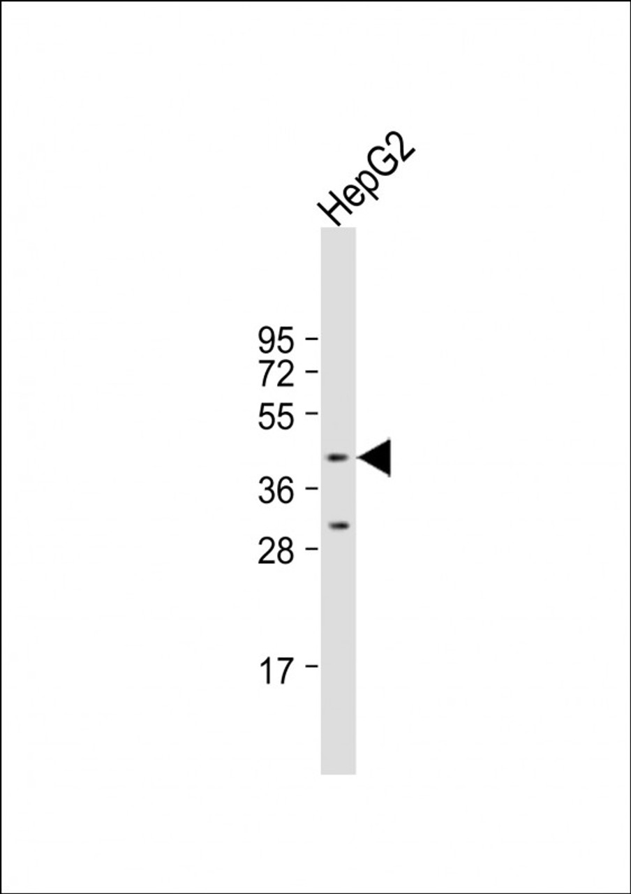 Western Blot at 1:1000 dilution + HepG2 whole cell lysate Lysates/proteins at 20 ug per lane.