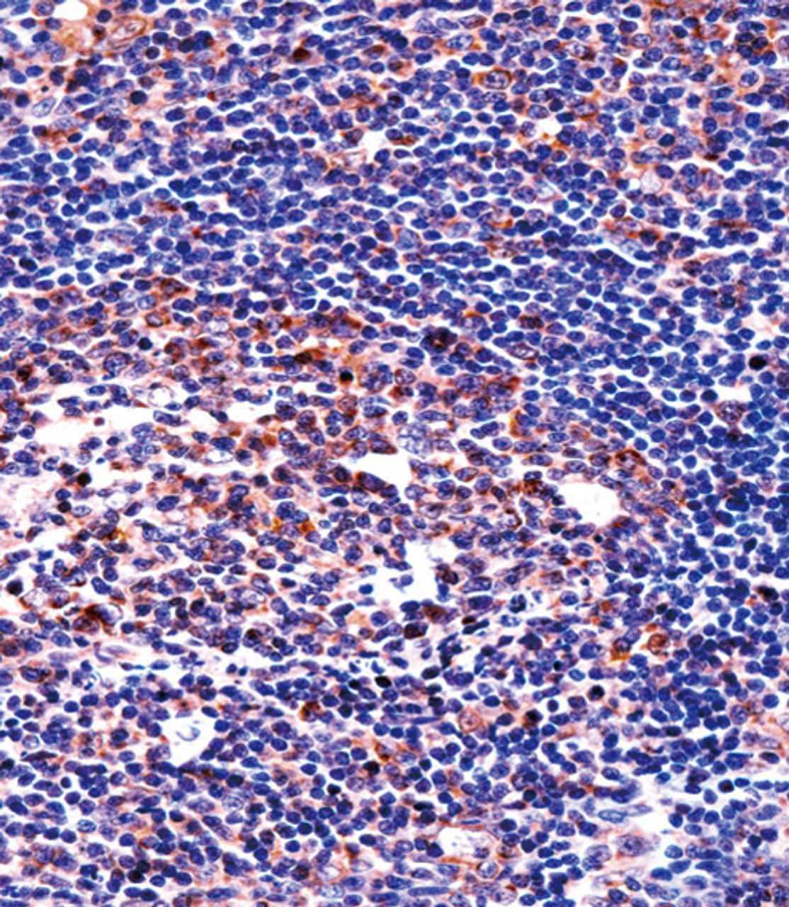 QPRT Antibody immunohistochemistry analysis in formalin fixed and paraffin embedded human tonsil tissue followed by peroxidase conjugation of the secondary antibody and DAB staining.