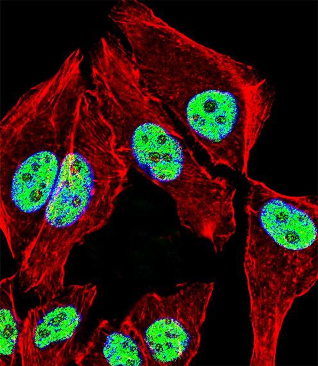 Fluorescent confocal image of A549 cell stained with ZNF207 Antibody (N-term) .A549 cells were fixed with 4% PFA (20 min) , permeabilized with Triton X-100 (0.1%, 10 min) , then incubated with ZNF207 primary antibody (1:25) . For secondary antibody, Alexa Fluor 488 conjugated donkey anti-rabbit antibody (green) was used (1:400) .Cytoplasmic actin was counterstained with Alexa Fluor 555 (red) conjugated Phalloidin (7units/ml) . Nuclei were counterstained with DAPI (blue) (10 ug/ml, 10 min) . ZNF207 immunoreactivity is localized to Nucleus significantly.