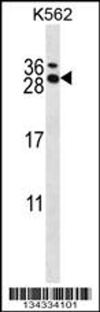 Western blot analysis in K562 cell line lysates (35ug/lane) .